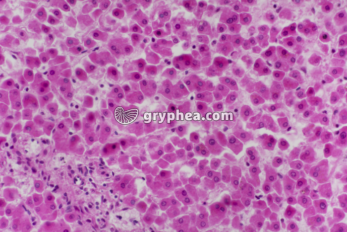 Foie humain x100 - gryphea.org